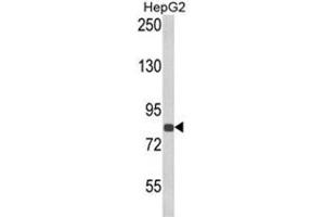 Western blot analysis of ECE1 Antibody (Center) in HepG2 cell line lysates (35ug/lane). (ECE1 antibody  (Middle Region))