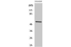 Western Blotting (WB) image for anti-IKAROS Family Zinc Finger 3 (Aiolos) (IKZF3) (Internal Region) antibody (ABIN3180687) (IKZF3 antibody  (Internal Region))