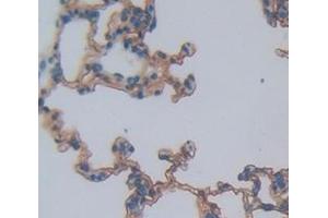 Figure. (CD166 antibody  (AA 28-527))