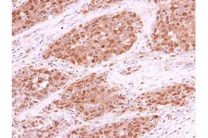Immunohistochemistry (IHC) image for anti-Replication Protein A1, 70kDa (RPA1) (C-Term) antibody (ABIN2856633)
