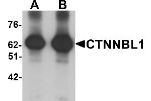 Western blot analysis of CTNNBL1 in human brain tissue lysate with CTNNBL1 antibody at (A) 1 and (B) 2 µg/mL.