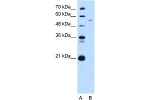 WB Suggested Anti-GAS7 Antibody Titration:  5. (GAS7 antibody  (C-Term))