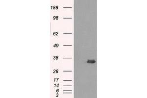 Image no. 1 for anti-Aldo-Keto Reductase Family 1, Member A1 (Aldehyde Reductase) (AKR1A1) antibody (ABIN1496547) (AKR1A1 antibody)