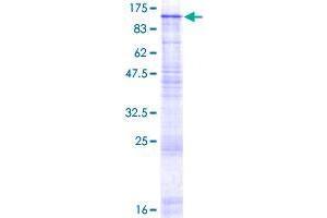 GBA2 Protein (AA 1-927) (GST tag)