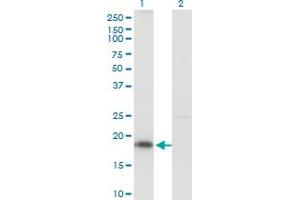 Western Blot analysis of KISS1 expression in transfected 293T cell line by KISS1 monoclonal antibody (M03), clone 1D11. (KISS1 antibody  (AA 46-145))