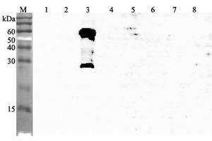 Western blot analysis using anti-ANGPTL3 (human), pAb  at 1:4'000 dilution. (ANGPTL3 antibody  (AA 194-213))
