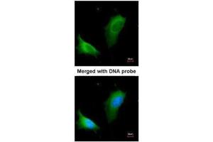 ICC/IF Image Immunofluorescence analysis of paraformaldehyde-fixed HeLa, using arginase I , antibody at 1:200 dilution. (Liver Arginase antibody)