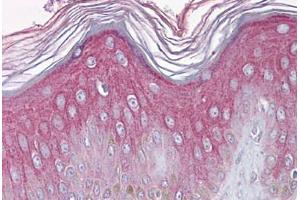 Immunohistochemistry (Formalin-fixed Paraffin-embedded Sections) (IHC (fp)) image for anti-Fibroblast Growth Factor Receptor 1 (FGFR1) (N-Term) antibody (ABIN790692)