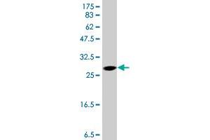 Western Blot detection against Immunogen (37 KDa) . (TDO2 antibody  (AA 307-405))