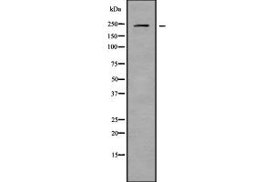 Western Blotting (WB) image for anti-Calcium Channel, Voltage-Dependent, L Type, alpha 1D Subunit (CACNA1D) (Internal Region) antibody (ABIN6260394)