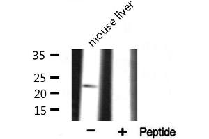 Western blot analysis on mouse liver lysate using RPS9 Antibody (RPS9 antibody  (Internal Region))