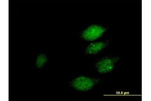Immunofluorescence of purified MaxPab antibody to DUSP22 on HeLa cell. (DUSP22 antibody  (AA 1-184))