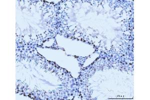 IHC analysis of MCM6 using anti-MCM6 antibody (ABIN7600037).