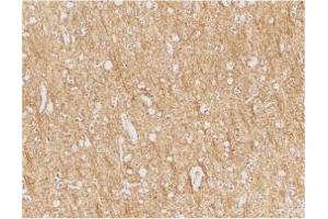Image no. 1 for anti-anthrax Toxin Receptor 1 (ANTXR1) (Internal Region) antibody (ABIN205769) (ANTXR1 antibody  (Internal Region))