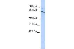 WB Suggested Anti-ZNF468 Antibody Titration:  0.