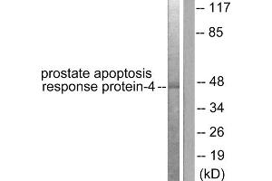 Western blot analysis of extracts from NIH/3T3 cells, using Prostate Apoptosis Response Protein-4 antibody (ABIN5976494).