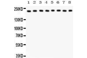 Anti- Integrin alpha 5 Picoband antibody, Western blotting All lanes: Anti Integrin alpha 5  at 0. (ITGA5 antibody  (AA 787-992))