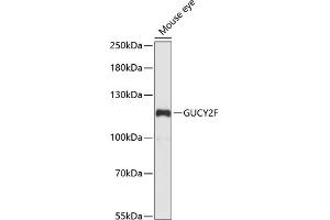 Western blot analysis of extracts of mouse eye, using GUCY2F antibody (ABIN7267553) at 1:1000 dilution. (GUCY2F antibody  (AA 250-460))