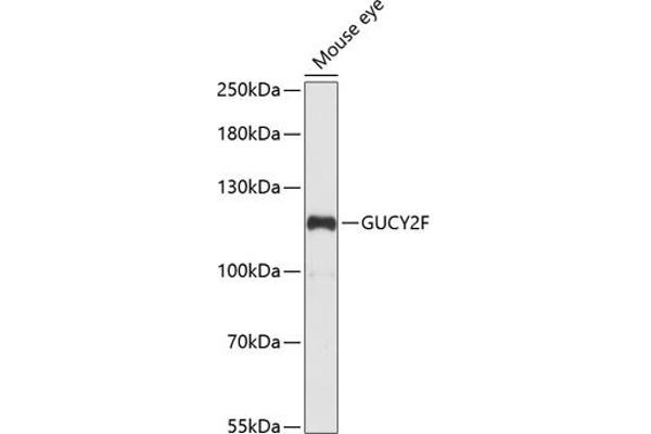 GUCY2F Antikörper  (AA 250-460)