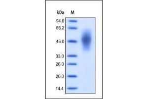 Human CEACAM-6, His Tag on SDS-PAGE under reducing (R) condition. (CEACAM6 Protein (AA 35-320) (His tag))