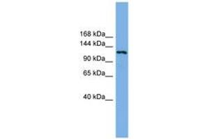 Image no. 1 for anti-Eukaryotic Translation Initiation Factor 4E Nuclear Import Factor 1 (EIF4ENIF1) (AA 143-192) antibody (ABIN6744173) (EIF4ENIF1 antibody  (AA 143-192))