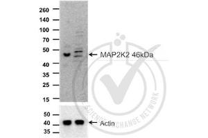 Images provided by the Independent Validation Program, badge number 029748. (MEK2 antibody  (AA 1-50))