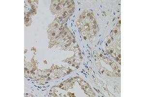 Immunohistochemistry of paraffin-embedded human prostate using MAPK1 antibody. (ERK2 antibody)