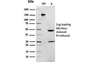 SDS-PAGE Analysis Purified MTAP Recombinant Mouse Monoclonal Antibody (rMTAP/1813). (Recombinant MTAP antibody  (AA 97-196))