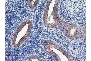 Image no. 2 for anti-ATG3 Autophagy Related 3 (ATG3) antibody (ABIN1496760) (ATG3 antibody)