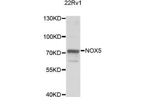 Western blot analysis of extracts of 22Rv1 cells, using NOX5 antibody (ABIN2564190) at 1:1000 dilution. (NOX5 antibody)