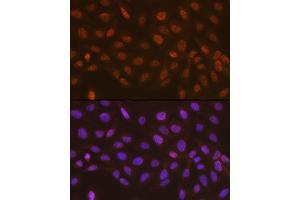 Immunofluorescence analysis of U-2 OS cells using Rad23A Rabbit mAb (ABIN7269824) at dilution of 1:100 (40x lens). (RAD23A antibody)