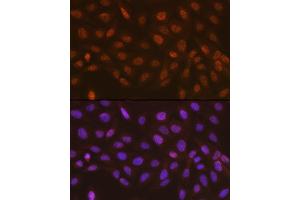 Immunofluorescence analysis of U-2 OS cells using Rad23A Rabbit mAb (ABIN7269824) at dilution of 1:100 (40x lens). (RAD23A antibody)