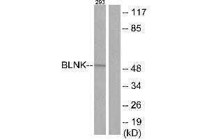 Immunohistochemistry analysis of paraffin-embedded human tonsil tissue using BLNK (Ab-96) antibody. (B-Cell Linker antibody)