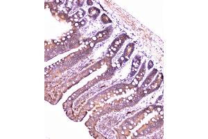 IHC analysis of PON1 using anti-PON1 antibody (ABIN6719356). (PON1 antibody  (AA 30-274))