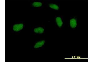 Immunofluorescence of purified MaxPab antibody to DNMT3A on HeLa cell. (DNMT3A antibody  (AA 1-912))