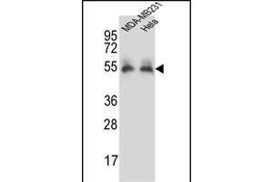 PRCP Antibody (N-term) (ABIN657308 and ABIN2846386) western blot analysis in MDA-M,Hela cell line lysates (35 μg/lane). (PRCP antibody  (N-Term))
