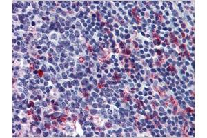 Human Tonsil: Formalin-Fixed, Paraffin-Embedded (FFPE) (FFAR2 antibody  (C-Term))