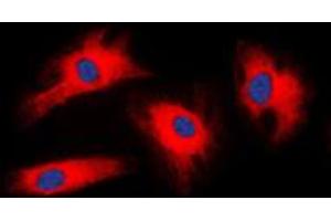 Immunofluorescent analysis of 14-3-3 zeta staining in HeLa cells. (14-3-3 zeta antibody  (Center))