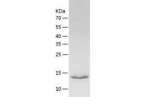 Western Blotting (WB) image for Hydroxypyruvate Isomerase (Putative) (HYI) (AA 42-190) protein (His tag) (ABIN7123383) (HYI Protein (AA 42-190) (His tag))