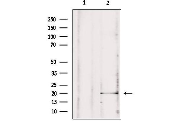 MPV17 antibody  (Internal Region)