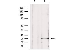 Western blot analysis of extracts from rat brain, using MPV17 antibody. (MPV17 antibody  (Internal Region))