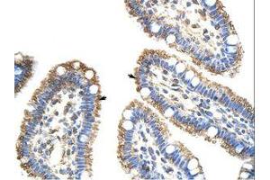 Image no. 1 for anti-Frizzled Family Receptor 9 (FZD9) (AA 181-230) antibody (ABIN202792) (FZD9 antibody  (AA 181-230))