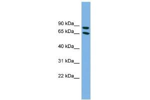 WB Suggested Anti-DAB1 Antibody Titration: 0. (DAB1 antibody  (Middle Region))