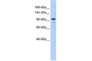 WB Suggested Anti-AMOTL1 Antibody Titration:  0. (AMOTL1 antibody  (N-Term))