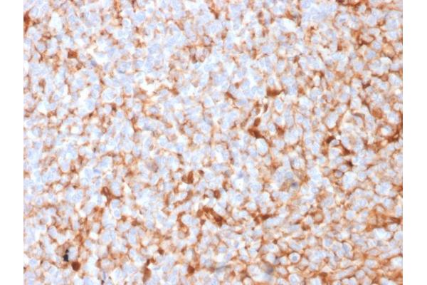 Recombinant Mammaglobin A antibody