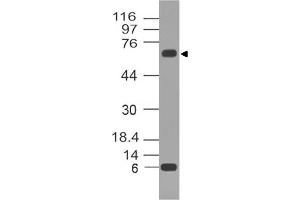 Image no. 1 for anti-Tumor Protein P73 (TP73) antibody (ABIN5027775) (Tumor Protein p73 antibody)