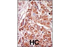 Immunohistochemistry (Paraffin-embedded Sections) (IHC (p)) image for anti-Eukaryotic Translation Initiation Factor 2-alpha Kinase 2 (EIF2AK2) (AA 11-42), (N-Term) antibody (ABIN392778)