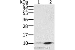 Western blot analysis of A431 and hela cell, using S100P Polyclonal Antibody at dilution of 1:650 (S100P antibody)