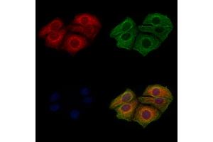 ABIN6256283 and ABIN6267449 staining Hela cells(4h of LPS treatment) by IF/ICC.
