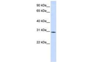 Image no. 1 for anti-RNA Binding Motif Protein 7 (RBM7) (AA 180-229) antibody (ABIN6740697) (RBM7 antibody  (AA 180-229))
